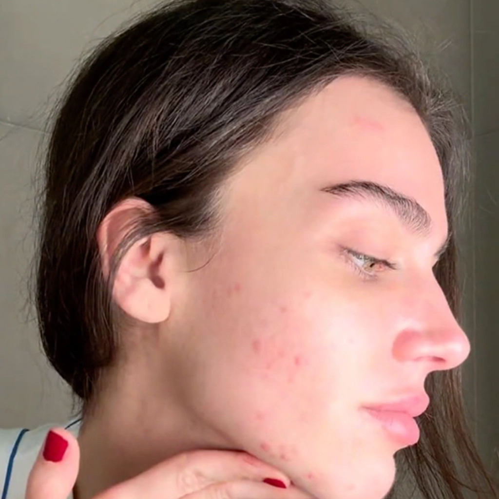 Öncesi